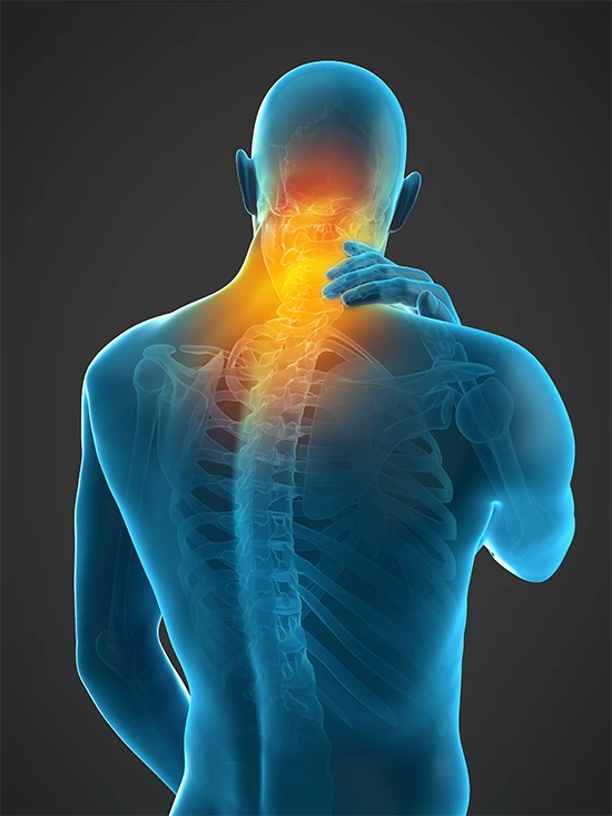 Medical image representing a person with neck and upper back pain
